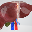 LIVER,-abdominal,-abdomen,-spleen,-pancreas,-pancreatic,-biliary,-hepatic,-artery,-vein,-portal-vein.png 6 PIÈCES Modèle 3D réaliste du foie humain - avec système biliaire, veines portales, veines et artères hépatiques, ligaments du foie