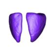 stl_lungs.stl 3D Model of Transposition of the Great Arteries Open Duct