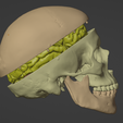 3.png 3D Model of Skull and Brain with Brain Stem