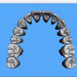 Dentes-Maxila-Robtoly-Unique-Exocad-02.jpg Teeth Upper Jaw - Exocad - Robtoly-Unique