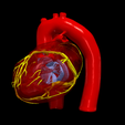 21.png 3D Model of Heart with Tetralogy of Fallot (ToF)