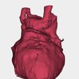 9.jpg congenital heart disease classification ( CHD )