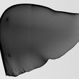 w3.jpg 3D Alchoholic liver disease cirrhosis hepatitis fatty model