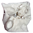 TB3.png Temporal bone with detailed inner ear structures