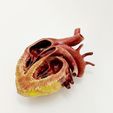 FullSizeRender-2.jpg Anatomical human obese heart in cross section