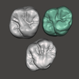 First-Molar-Anatomy-Collection.png Maxillary First Molar Anatomy Mini Collection