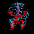 i6.jpg 3D Model of Brain Arteriovenous Malformation