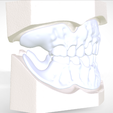 5.png Digital Try-in Full Dentures for Injection Molding