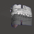 scrnnn.png Orthodontics dental model 2