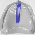 Dental-Roy-Mac-Gregor's-Spacer-1.png ESPACIADOR DENTAL COLECCIÓN 1