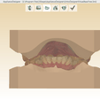 Screenshot_4.png Digital Orthodontic Study Models with Virtual Bases