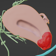 CERVICAL-CANCER-7.png 3D CÁNCER DE CUELLO UTERINO CON ÚTERO, GANGLIOS LINFÁTICOS, SISTEMA URINARIO, VÉRTEBRAS Y PELVIS