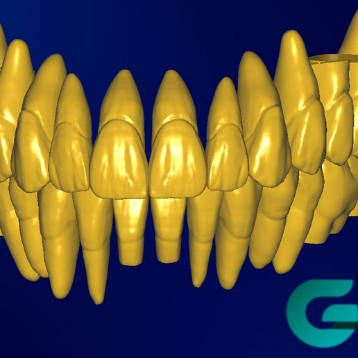 STL file GRIN DESIGN 2023 Exocad Tooth library 🦷 ・3D printing template ...