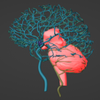 17.png 3D Model of Brain and Aneurysm