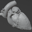 17.png 3D Model of Heart (2.3.4.5 chamber view) - 4 pack