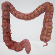 colon,-intestine,-mesenteric,-diverticulitis,-inflammation,-anatomy,-abdominal,-abdomen-3.png 3D Дивертикулит толстой кишки (обновлено)