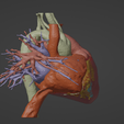 4.png 3D Model of Human Heart with Atrial Septal Defect (ASD) - generated from real patient