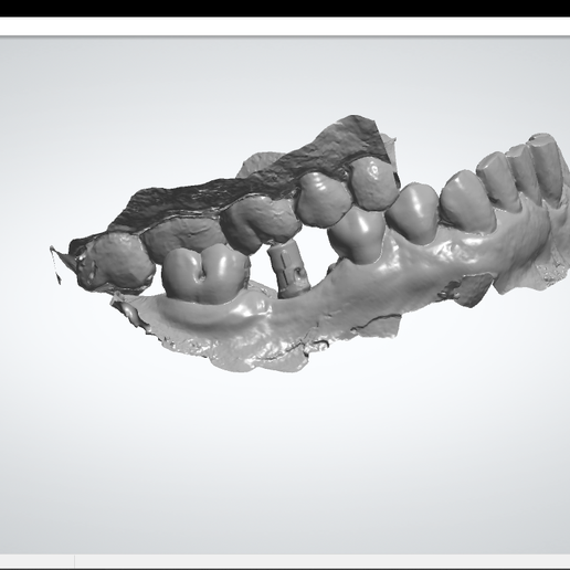 Implant study models 3D model