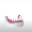 8.png Digital Single Jaw Full Denture
