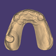 OCLUSAL-SUP-ORIGINAL.png ENCERADO / MOCK-UP #2