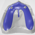 Dale-E.-Smith's-Spacer-1.png ESPACIADOR DENTAL COLECCIÓN 1