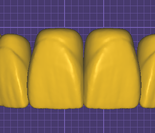 Ashim V2.0 & 3.0 for Exocad
