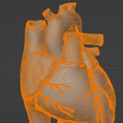9.png 3D Heart Anatomy with Codominance