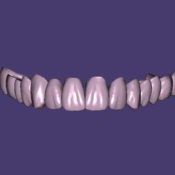 Capture.jpg Файл STL Dental Bridge FULL ARCH・Дизайн 3D-печати для загрузки3D