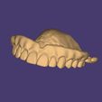 Clipboard-2024-12-21-00-36-31.jpg DIGITAL FLEXIBLE UPPER PARTIAL DENTURE  (3D models !!!) - 7 stl files for download)