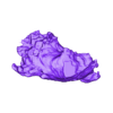 STL00002.stl 3D Model of Human Heart with Patent Ductus Arteriosus (PDA) - generated from real patient