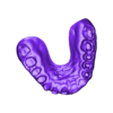 2024-09-16_99999-002-17-16-15-14-13-12-11-21-22-23-24-25-26-27-digitalwaxupmodel.stl FREE practice model