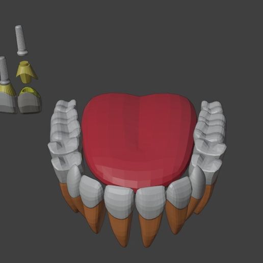 1.jpg 3D-Modell von Zahnimplantaten - Dentalmodell