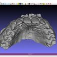 & MeshLab_64bit v1.3.3 - [Project_1] SUPERIOR MAXILLARY from Intraoral Scan - AREA3D- Patient A. TOP DENTURE