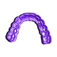 OcclusalBiteAligner.stl Digital Full Dentures with Combined Glue-in Teeth Arch