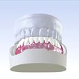 6.jpg Digital Single Jaw Full Denture