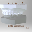 Screenshot_7.png Digital Orthodontic Study Models with Virtual Bases