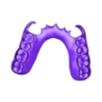 789513050_20240628_0821_Tech_01_flexka_A1_0_Monoblock.stl DIGITAL FLEXIBLE PARTIAL REMOVABLE DENTURE (4 stl files)