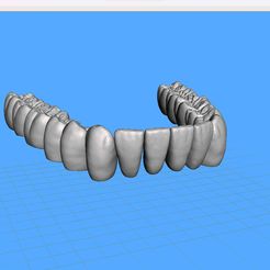 Dentes-Mandibula-Ashortia-Exocad-01.jpg STL file Teeth mandibule - Ashortia - Exocad・3D printing template to download