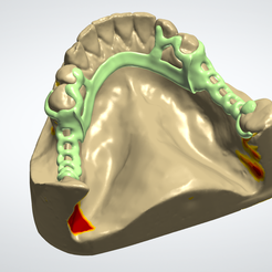 Dental-Framework-1.png Dental Framework, Lower Jaw Dental Model