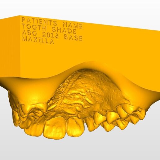 Maxilla-Details.jpg Maxilla and Mandible orthodontic study models with an ABO 2013 base.