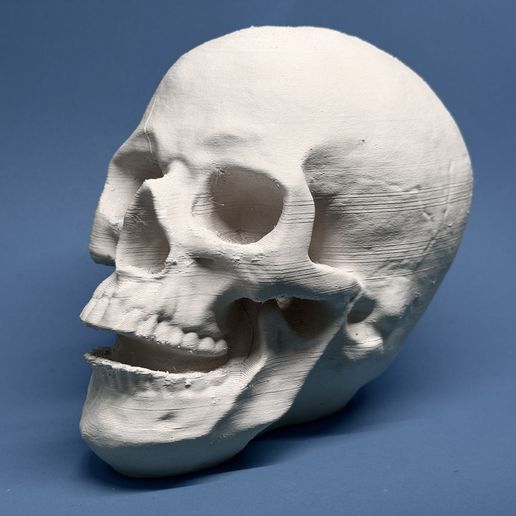 Skull