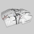 wf3.jpg Brain hemorrhage types model