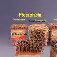 2269.jpg adaptation epithelial cell changes normal to cancer Low-poly 3D model