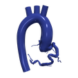 1.png 3D Model of Aorta and Coronary Arteries