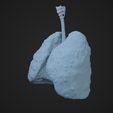 HLC_Render1.png Human Lung Cancer