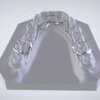 Snapshot_2017-3-1_13-4-55.jpg STL file Digital Dr.Williams's Ortho Appliance・3D print object to download
