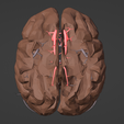 5.png 3D Model of Brain and Blood Supply - Circle of Willis