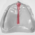 I-Spacer-1.png ESPACIADOR DENTAL COLECCIÓN 1