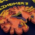 ps9.jpg Alzheimer Disease Brain coronal slice