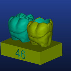 Screenshot_1.png Файл STL Restorative model of the 46th tooth for dental students・Дизайн 3D принтера для загрузки